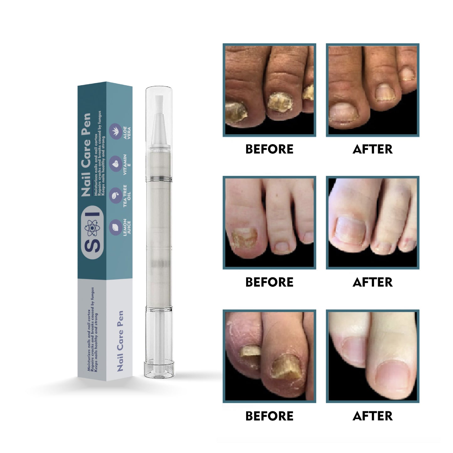 Nail Care Pen - SALE