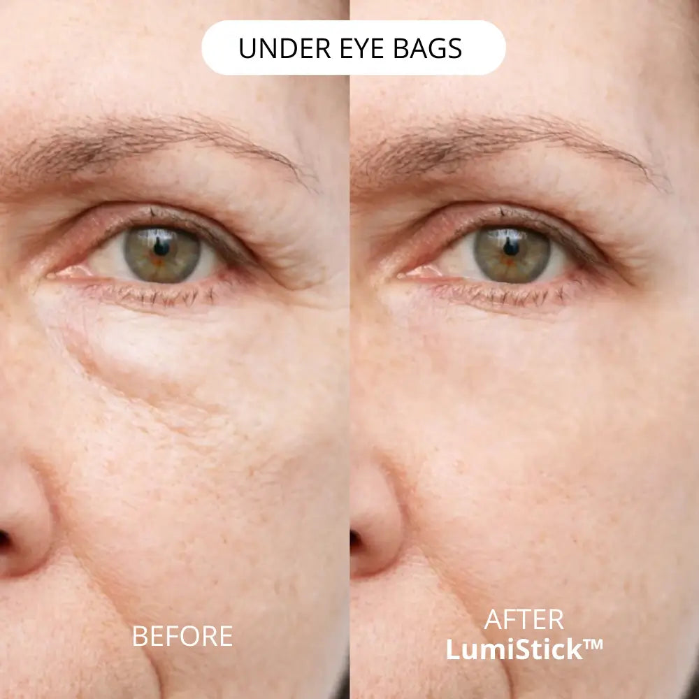 Lumistick Eye Balm