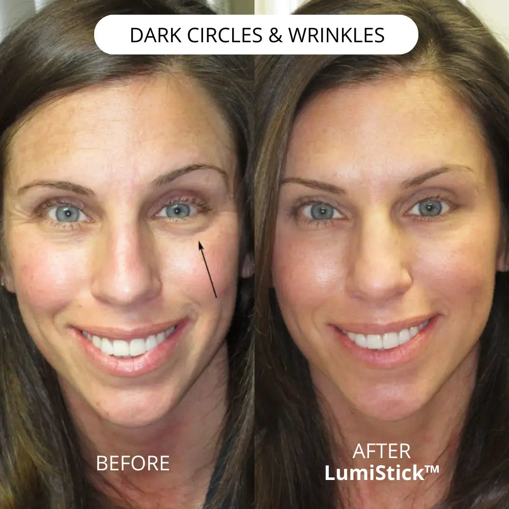 Lumistick Eye Balm